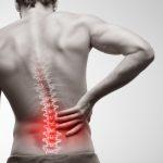 Back Pain After Gallbladder Surgery