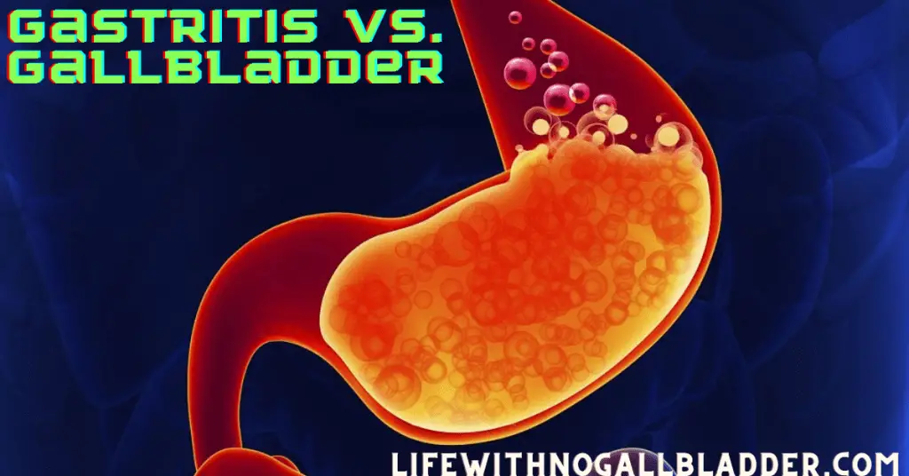 Gastritis vs. Gallbladder