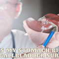 Why is My Stomach Bigger After Gallbladder Surgery?