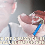 Why is My Stomach Bigger After Gallbladder Surgery?